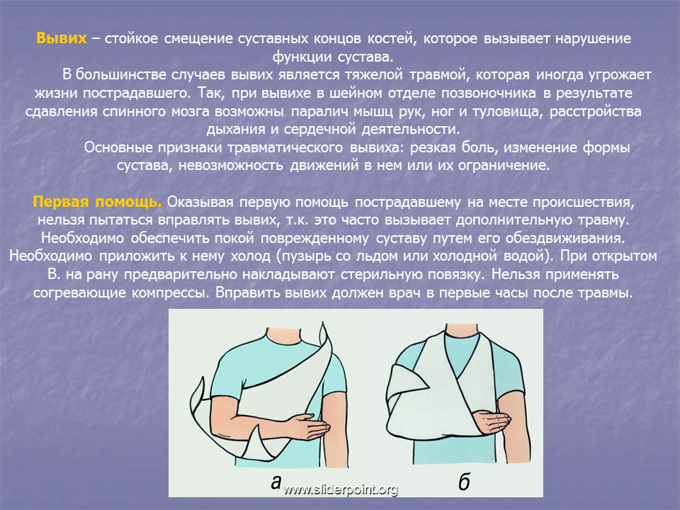 Какую помощь оказать при вывихе