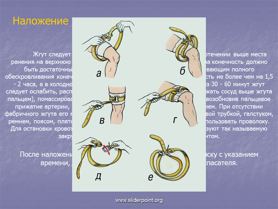 На какое время накладывают артериальный жгут. Место наложения жгута при укусе ядовитых змей. Места наложения жгута Эсмарха. Наложение жгута при кровотечениях. Жгут накладывается при.