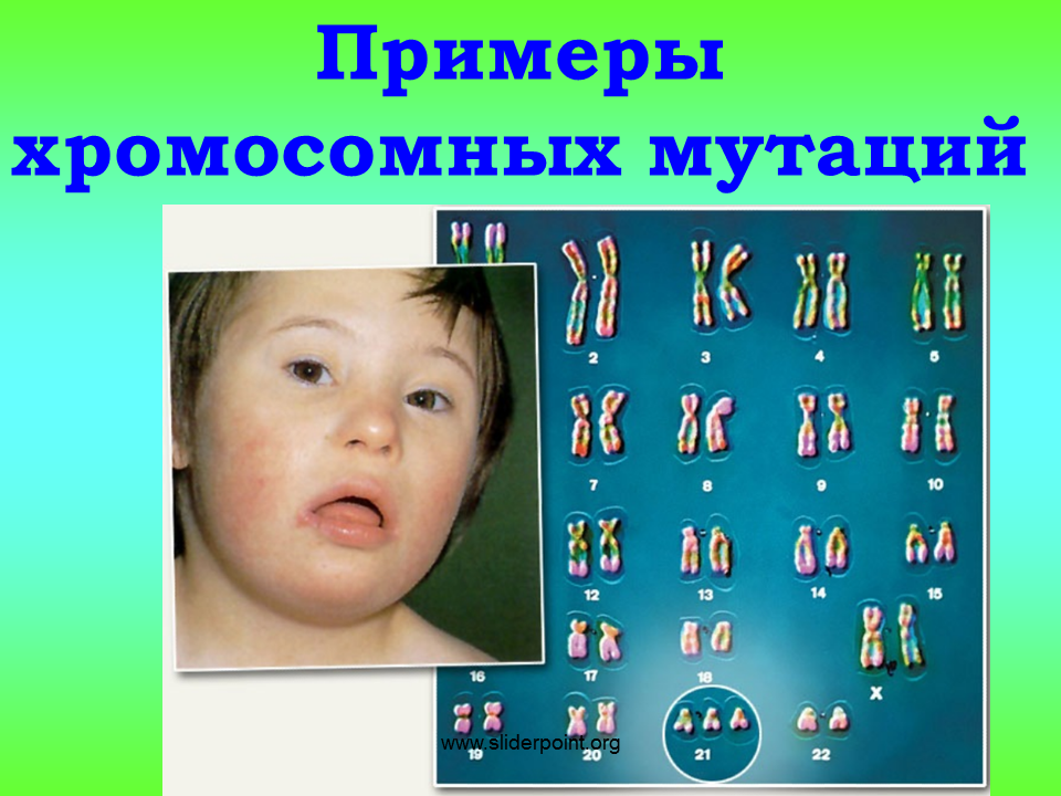 Хромосомные мутации. Хромосомные мутации примеры. Примеры хромосомных мутаций у человека. Синдром Дауна хромосомная мутация. Форма изменчивости дауна