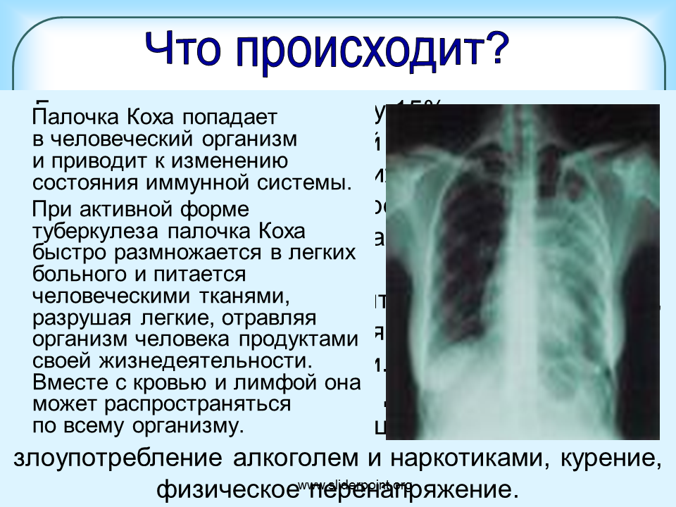 Причины изменений в легких. Палочка Коха туберкулез. Формы заболевания туберкулеза.