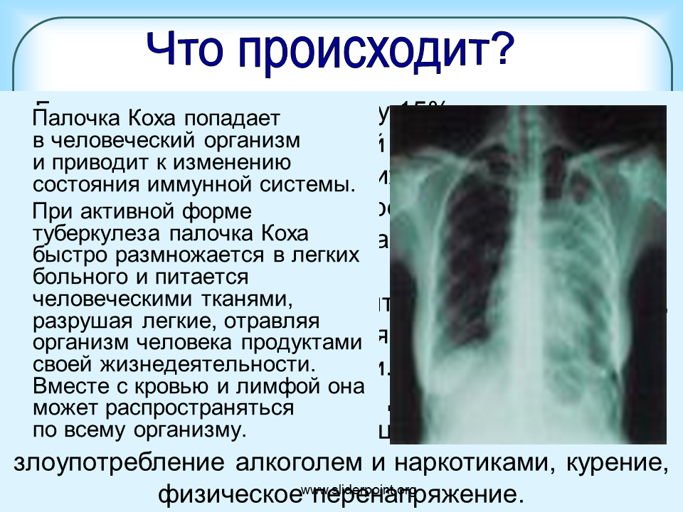 Палочка Коха туберкулез. Формы заболевания туберкулеза.