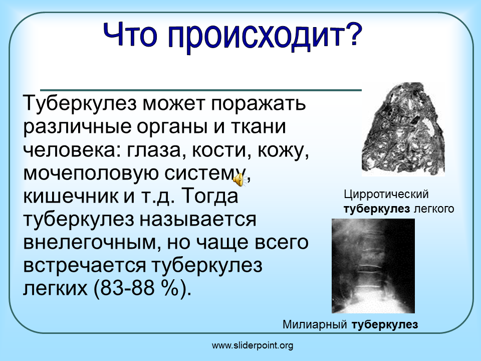 Туберкулез 7 класс. Туберкулез презентация. Туберкулёз лёгких презентация. Туберкулез легких презентация.