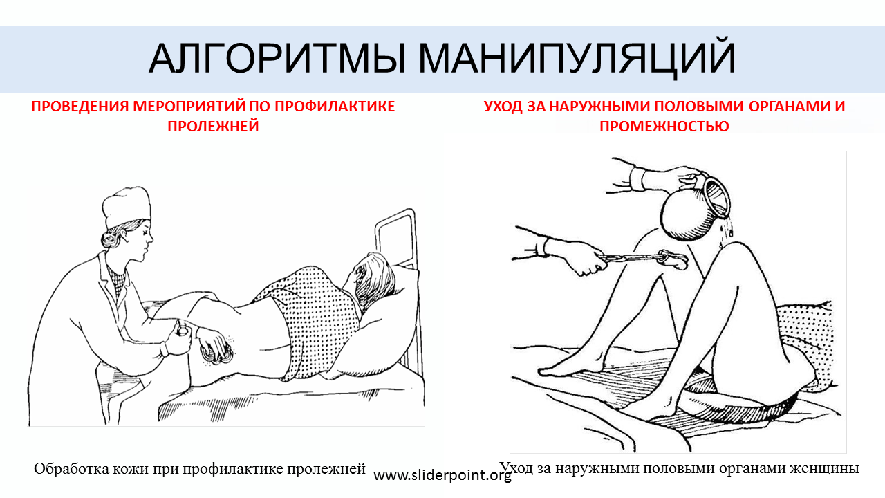 Алгоритмы уход манипуляции. Выполнение мероприятий по профилактике пролежней. Профилактика пролежней у тяжелобольных алгоритм. Проведение манипуляций по профилактике пролежней. Алгоритм выполнения пролежней профилактика Сестринское.