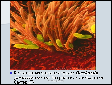    Bordetella pertussis (     )