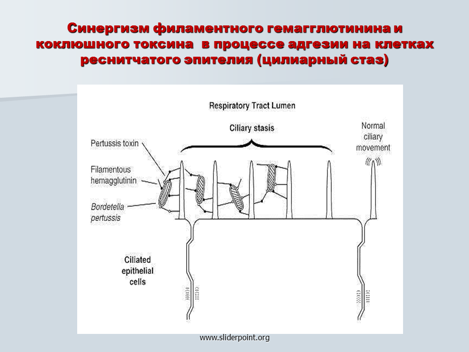 Патогенез коклюша схема. Механизм действия токсина коклюша. Коклюш педиатрия патогенез. Коклюш схема.