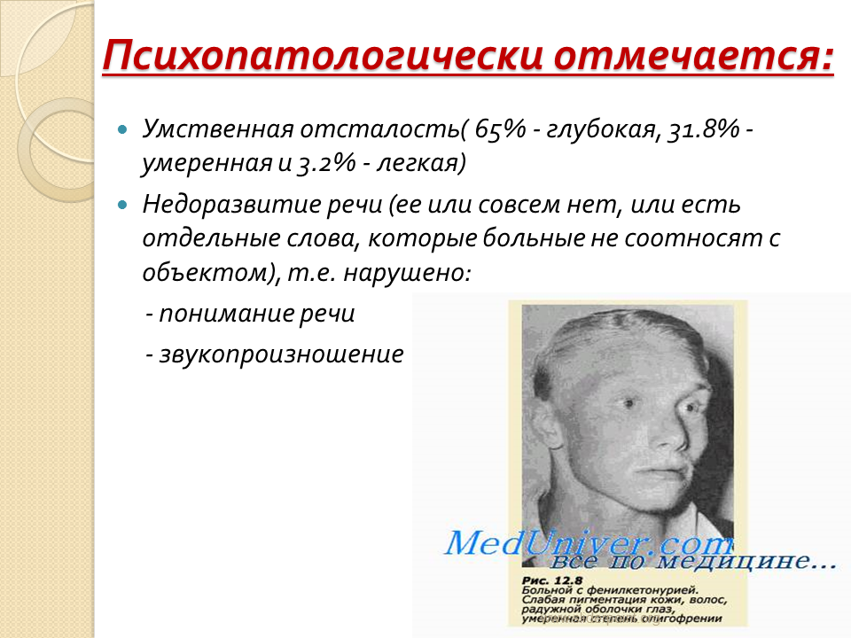 Наследственной умственной отсталости. Умственная отсталость. Глубокая умственная отсталость. Олигофрения легкой степени.