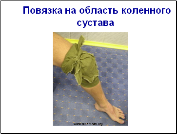Повязка на область коленного сустава