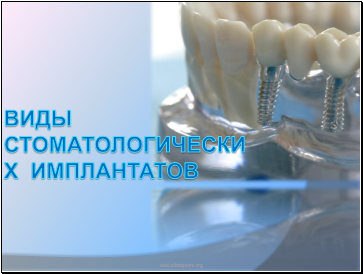 Виды cтоматологических имплантатов