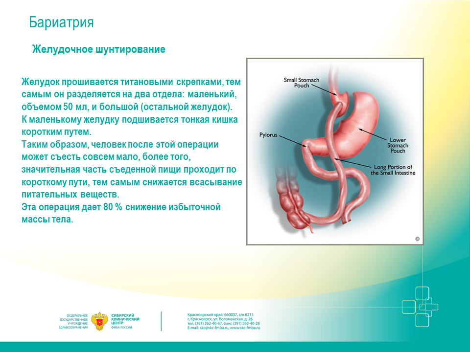 Бариатрия желудка москва