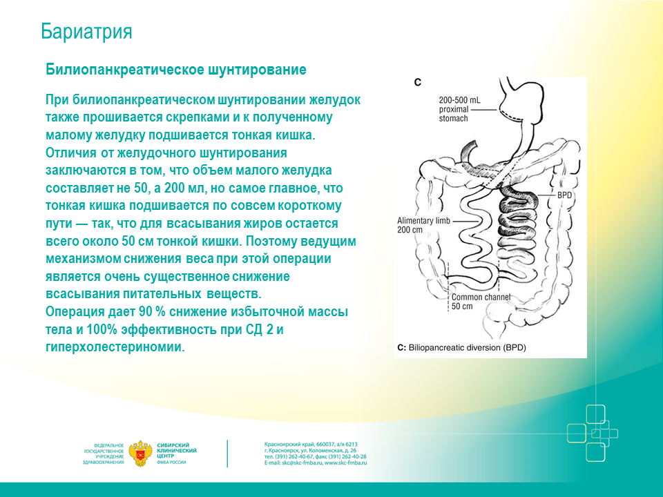 Суть бариатрической операции. Бариатрия шунтирование желудка. Билиопанкреатическое шунтирование. Билиопанкреатическое шунтирование желудка что это. Билиопанкреатическое шунтирование лапароскопическое.