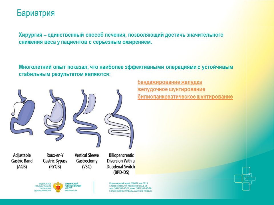 Бариатрическая операция ростов