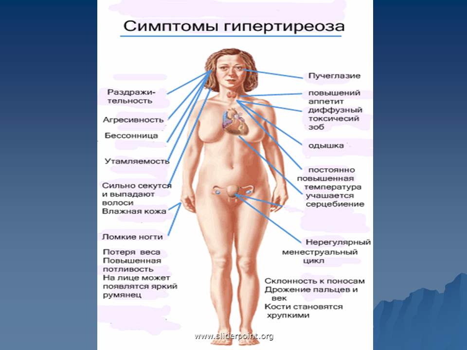 Заболевание при избыточной секреции щитовидной железы. Половая система при гипертиреозе. Клинические проявления при гипотиреозе и гипертиреозе. Заболевания щитовидной железы (гипертиреоз, тиреотоксикоз)..