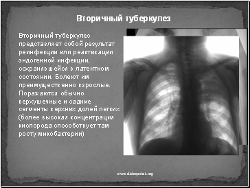 Вторичный туберкулез