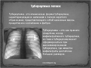 Туберкулема легких