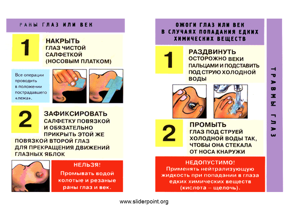 Оказание первой помощи при несчастном случае. Оказание первой помощи пострадавшему. Оказание помощи при травме глаз. Оказание 1 помощи при травме глаз.