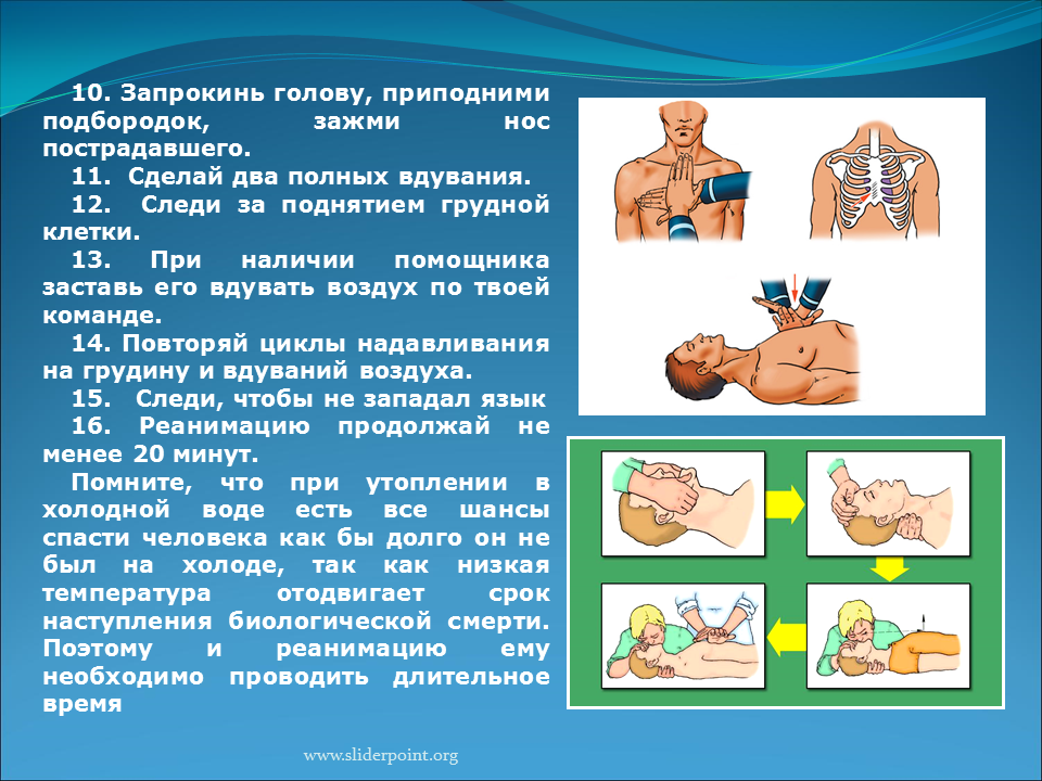 Презентация утопление реанимация