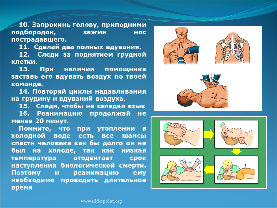 Первая помощь утонувшему. Сердечно-легочная реанимация при утоплении. Реанимационные мероприятия при утоплении. Реанимация при утоплении. Легочная реанимация при утоплении.